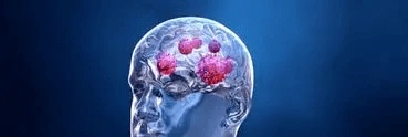 Prediction-Of-Glioblastoma-Survival-Using-Techniques-Based-On-Pre-Operative-Brain-MRI-Imaging-PhD-Research-Directions-For-2022